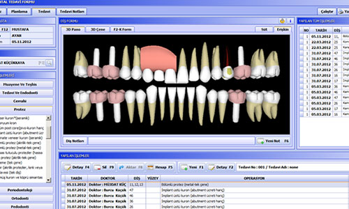 Macrodental Teknik Destek Paketi